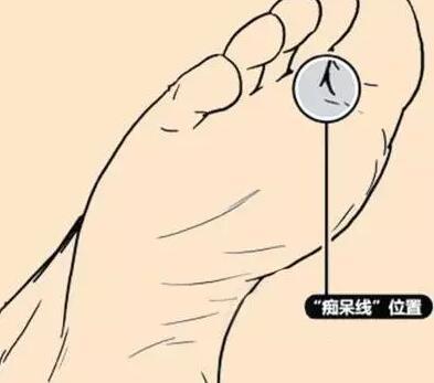 预防痴呆只要揉腿垫脚这么简单?