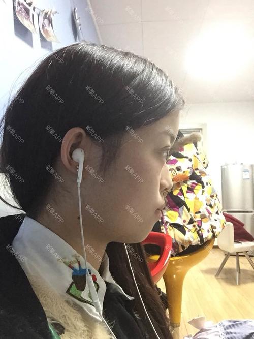 我是方脸型,中部是凹面型,我想做v-line和鼻综合,不想做脂肪充填和