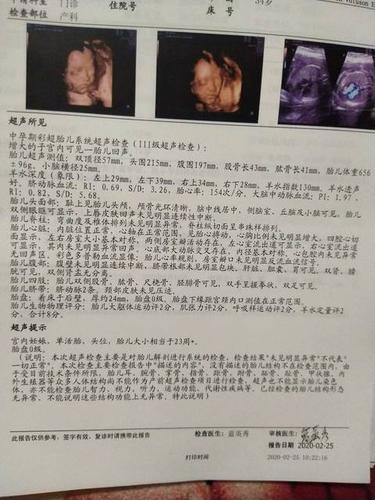 已生女宝的四维彩超单,想知道是男宝宝还是女宝宝?