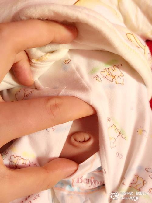 宝宝一个月了!肚脐没收好!怎么办?