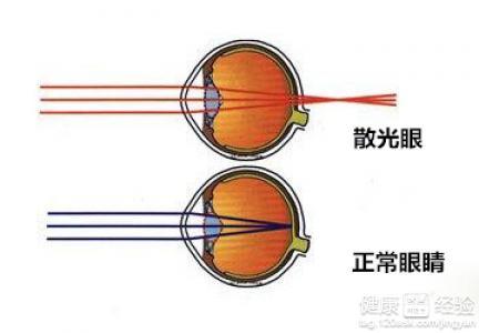 散光眼有什么症状