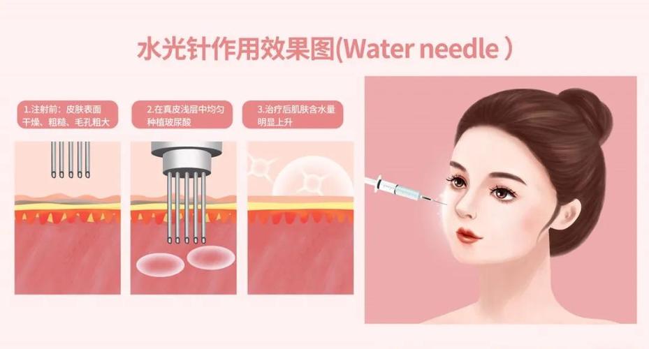 水光针注射后出现反干反黑,该如何避免?_手机搜狐网