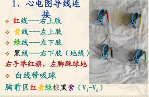 心电图"零基础"