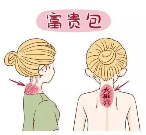 俗称"富贵包"
