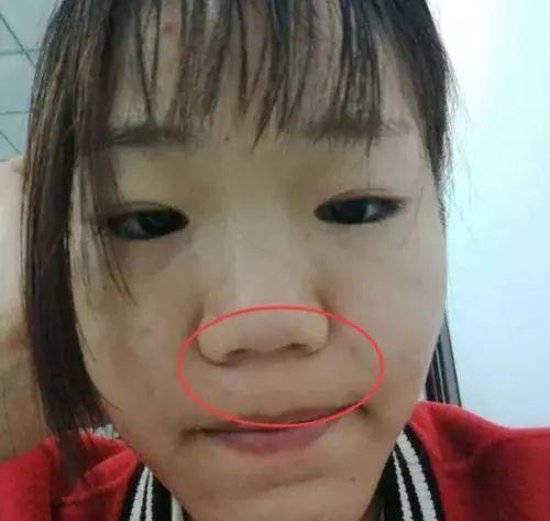 张嘴睡觉会毁容?不知道的赶紧来看看