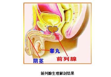 前列腺囊肿的手术治疗