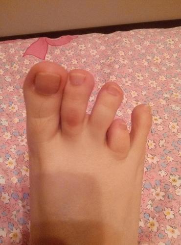 第四脚趾短小,自卑