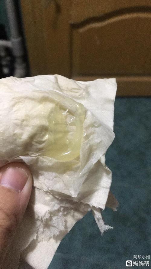 女生白带是什么意思女孩子有白带是什么原因引起的