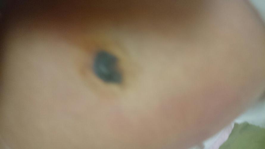 这段时间隔两三天肚脐眼