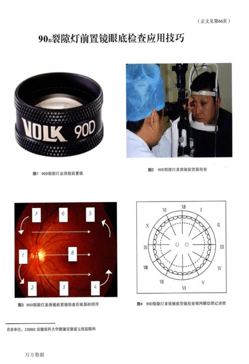 90d裂隙灯前置镜眼底检查应用技巧pdf4页