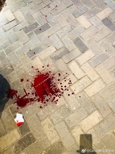 ▼▼▼血流一地一位男子头部被砸得不轻钢化玻璃碎了一地,大悦城骑鹅