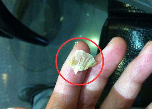 但你有没有发现这样一个现象:有的人的耳屎是薄片状,并且是干燥的;而