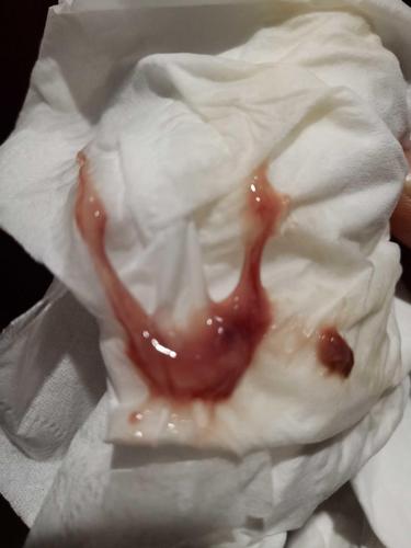 这样算见红吗白带里有血已经三天了多久