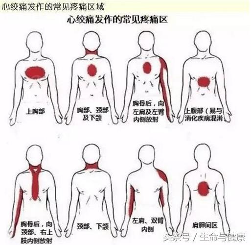 接连抢救两位"80后心梗患者,心梗缠上年轻人?有症状,别大意