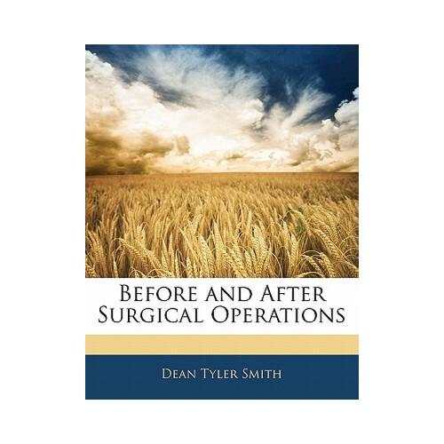 beforeafter卡通,beforeafter图片 【预订】before and after surgical operations