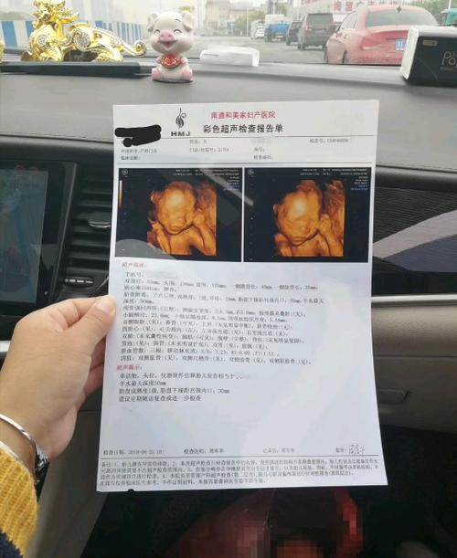 2,已生男宝的四维彩超单子:两次的四维彩超单,有会看男女的么,挺好奇