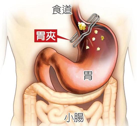为什么胃嘴总是不舒服怎么办嘴苦恶心胃不舒服怎么回事