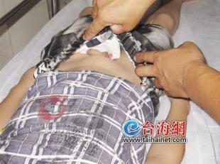 9岁小男孩掏"小鸟"尿尿 竟遭"狗扯蛋"