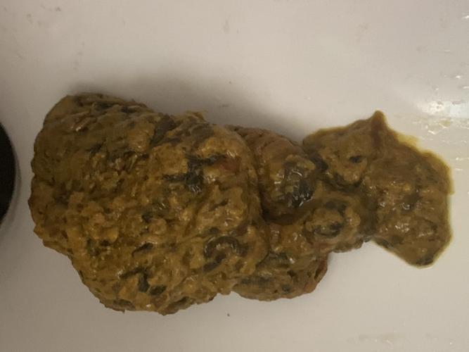 这样的大便正常吗