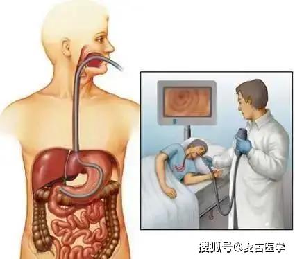 今天,我们通过图解让你了解胃镜检查的全过程,事先有充分的感性认识