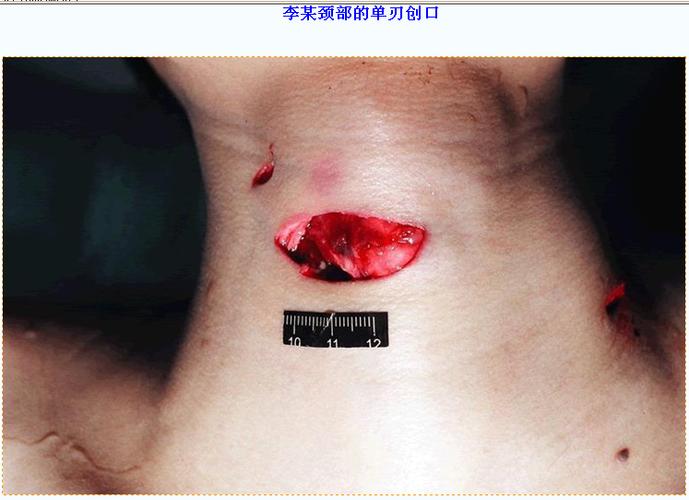 糊涂瓷的相册 - 广州冼村杀人案现场及验尸