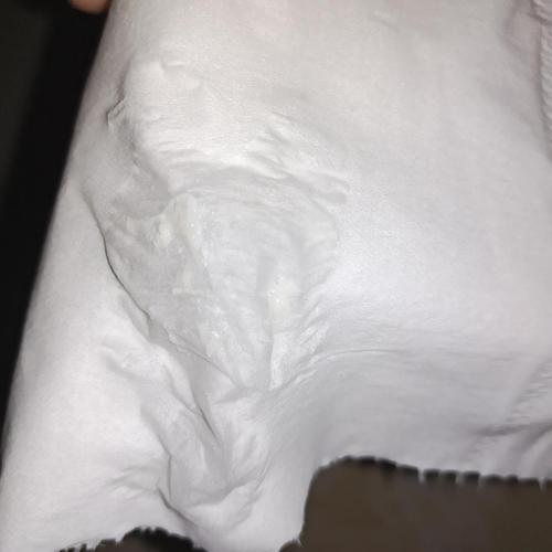 这样的白带正常码 有图慎入!