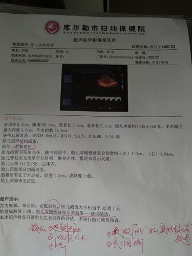 还能改变吗?能顺产吗?左脑室宽1.0cm,需要做胎儿脑核磁吗?