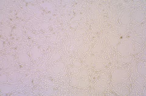 f12 10�s 气相:空气,95%;二氧化碳,5% 温度:37℃ 40x光镜下图片