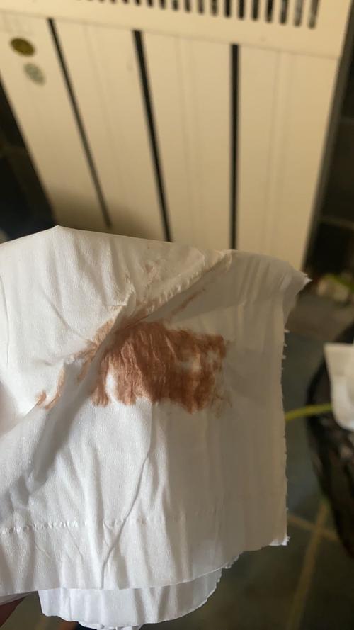 [试管婴儿]姐妹们帮忙看看这是着床出血吗?