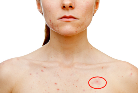 得肝病的人,多有"1疼2臭3红",想健康,4件事戒掉,肝会感激你