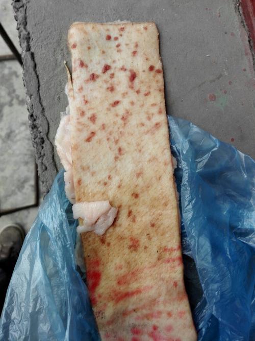 今天买了一块猪肉发观肉皮有好多红斑点是病猪吗