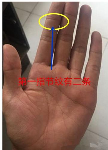 食指第一指节纹有三条可称为三约纹,表示着壮志蓬勃,有着很高的聪明