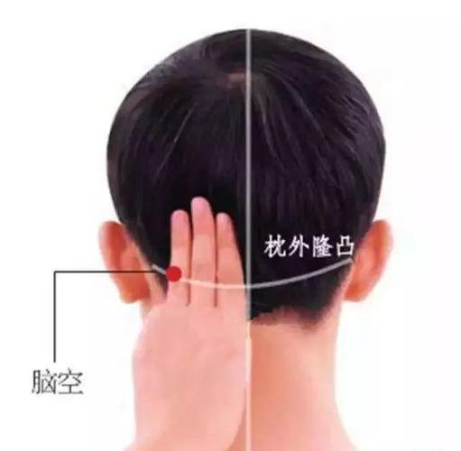 脑空穴:头痛目眩