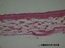 变移上皮扩张时 中国海洋大学 刘子夏