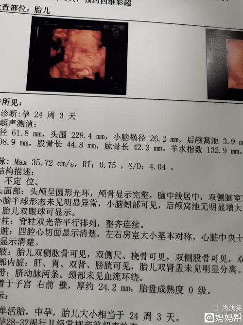 四维彩超出来了,我怎么感觉宝宝一脸严肃的样子,看图像男孩还是女孩