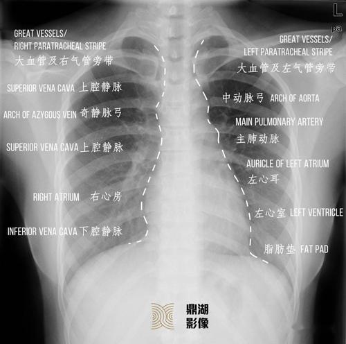 肺尖,第1肋骨:如肺上沟癌,第