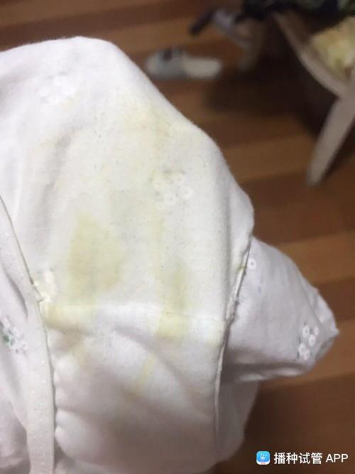 [试管婴儿]孕12周,黄色的水样分泌物流出