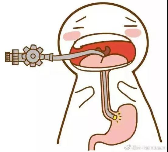 先说说胃镜.