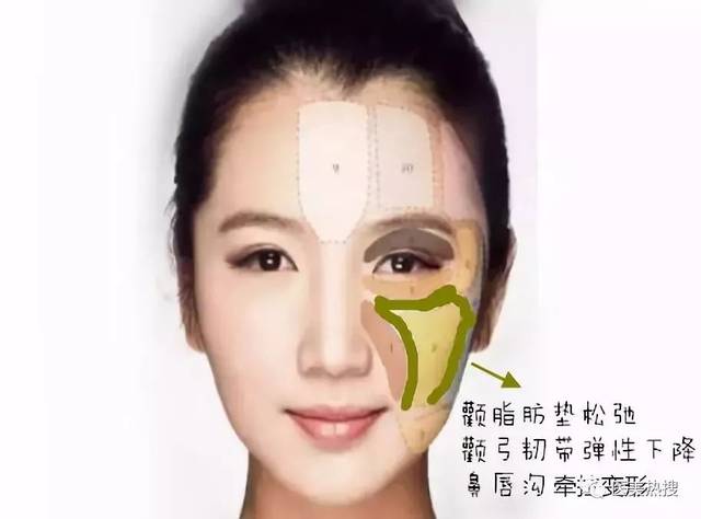 笑肌断层的位置主要在颧颊部和鼻唇部之间.