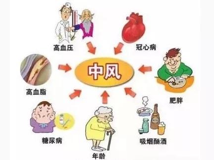 fast法则可以帮助大家快速识别脑卒中的发生时间就是大脑少一分延误多