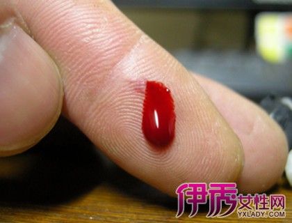[【图】夏天伤口发炎红肿怎么办 教你处理日常生活中的小伤口