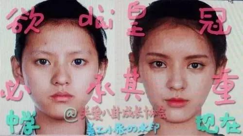 张予曦也被传整容过.