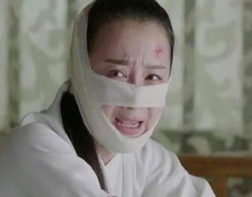 35岁李依晓近照,曾被叶璇的狗咬伤,接近"毁容"