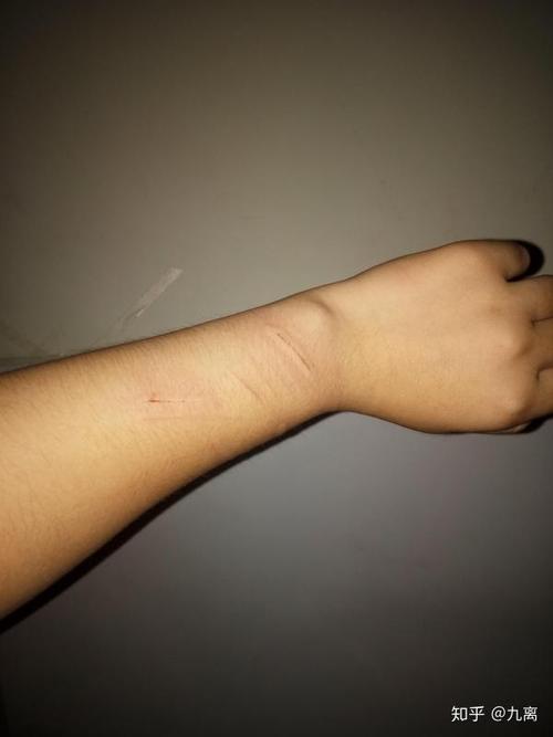 你们有人尝试过自残吗?那是怎样一种感受?