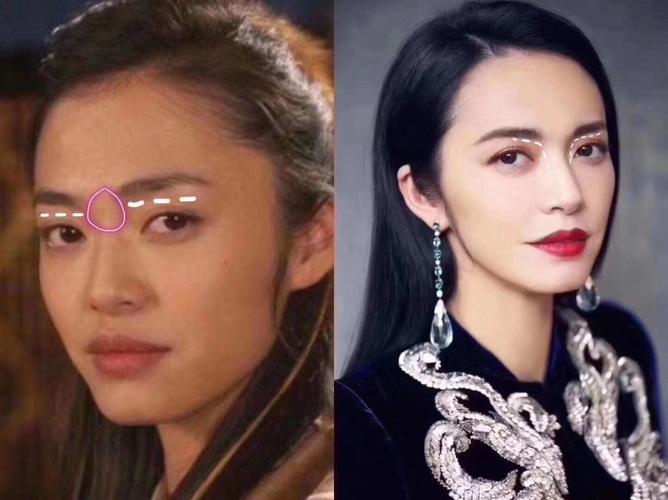 眉骨—很多明星都操作过的部位