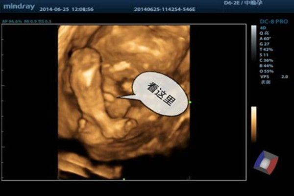 四维3个亮点是男孩 四维报告数据看男女的秘诀