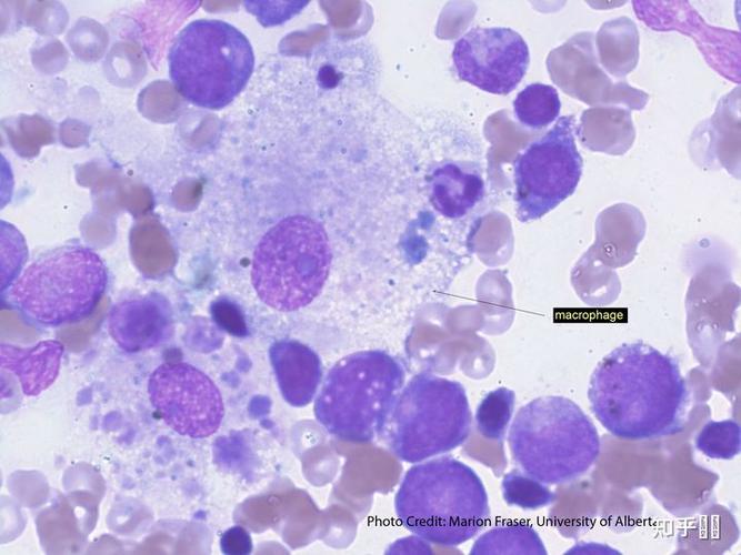 当具有典型形态时在光镜下是能够被区分的,其主要特点如下: 来源