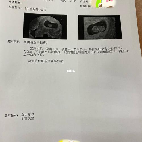 9周啦～医生给宝宝拍了张清楚好看的彩超照片_子宫_怀孕_孕吐_母婴_孕