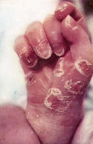 女人性病高清图片