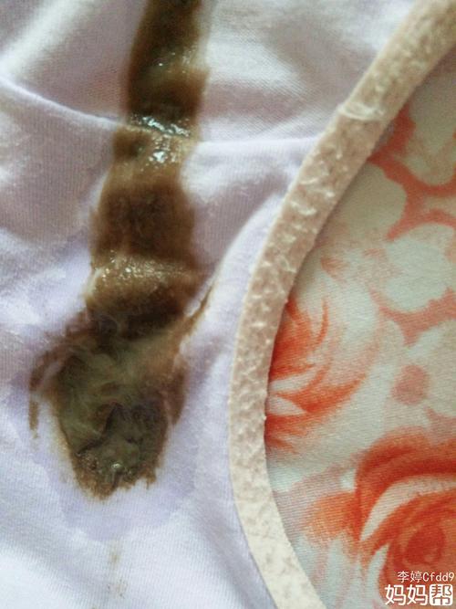 有宝妈检查过宫口有分泌物吗